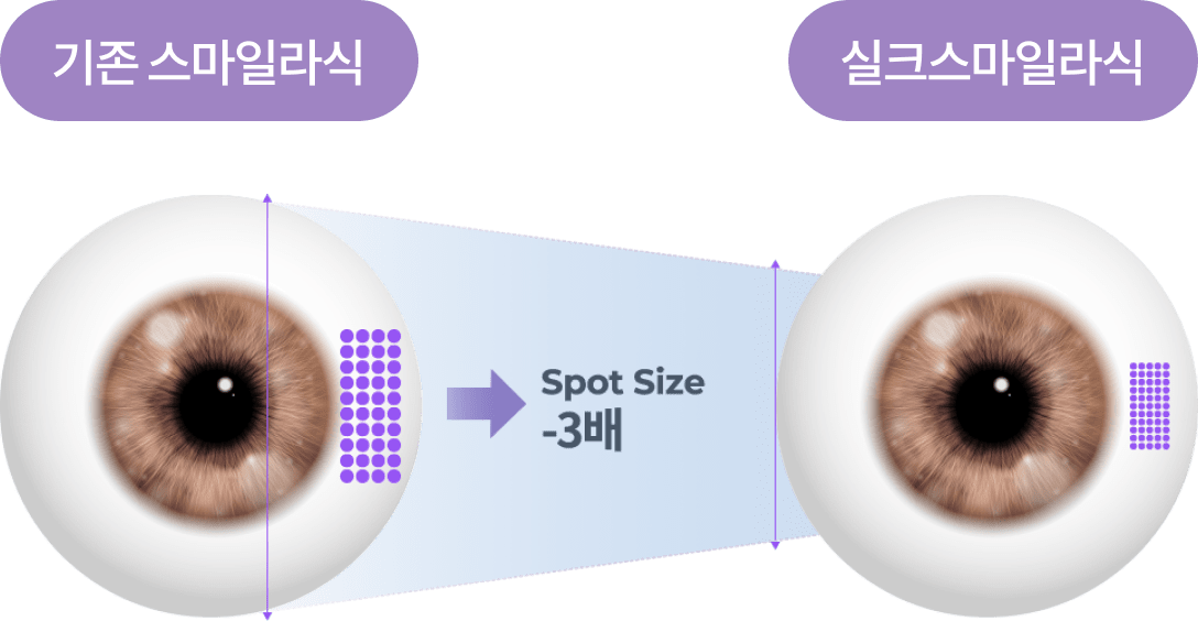 최소 스팟 이미지