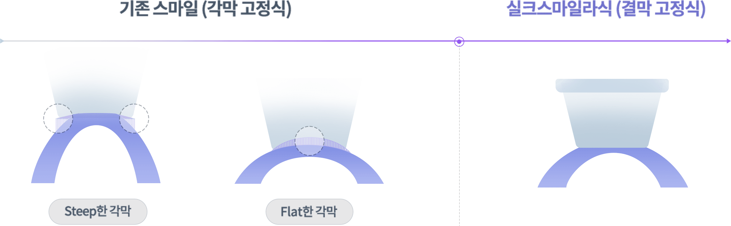 최소 스팟 이미지