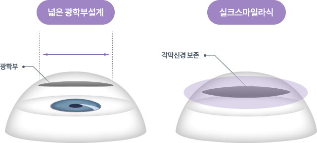 실크스마일라식 장점 이미지