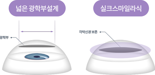 실크스마일라식 장점 이미지