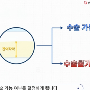 강남서울밝은안과