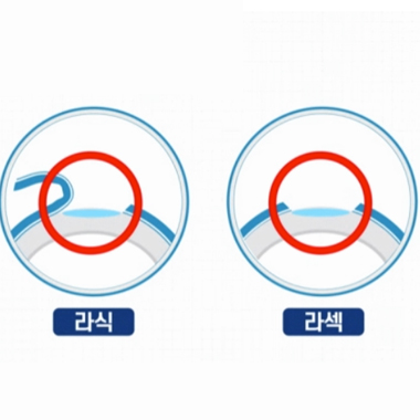 강남서울밝은안과
