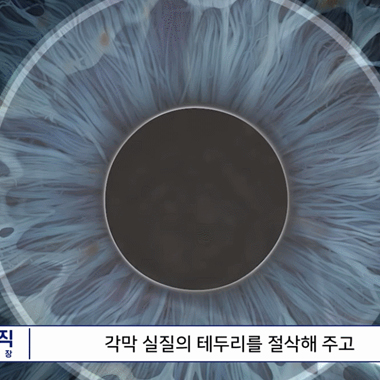 강남서울밝은안과