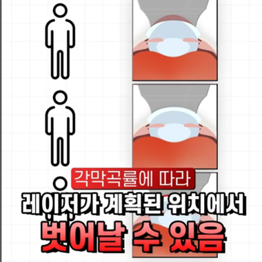 강남서울밝은안과