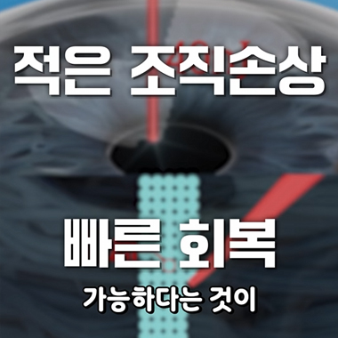강남서울밝은안과